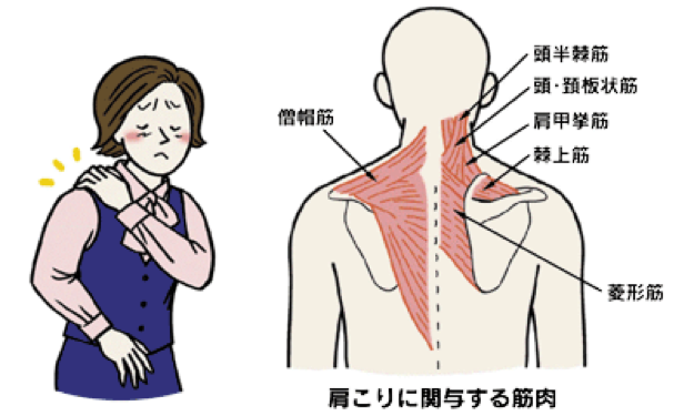 第5回 そもそも肩こりとは 横浜 みなとみらいの整形外科ならプライムコーストみなとみらいクリニック